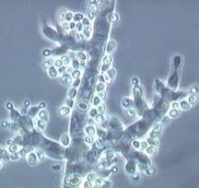 TRICHODERMA.SP